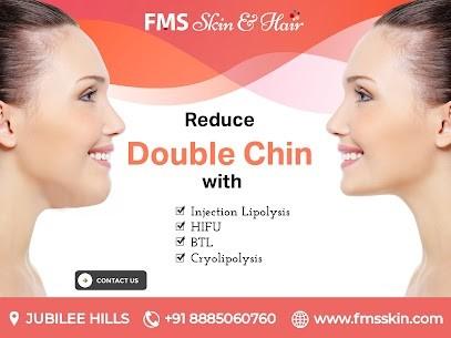Double Chin Treatment In Kondapur | FMS Skin and Hair Clinic