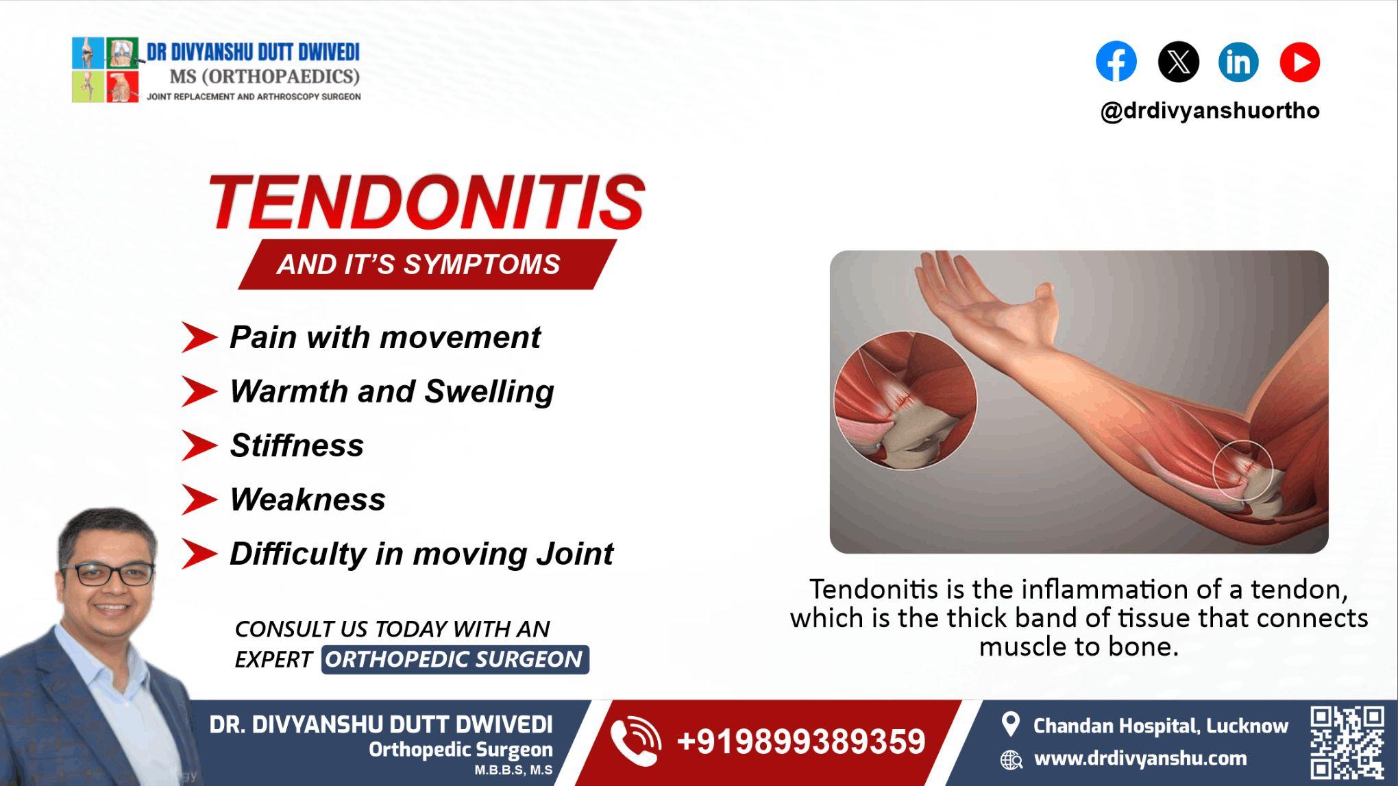 Relieve Tendonitis Pain with Dr. Divyanshu Dutt