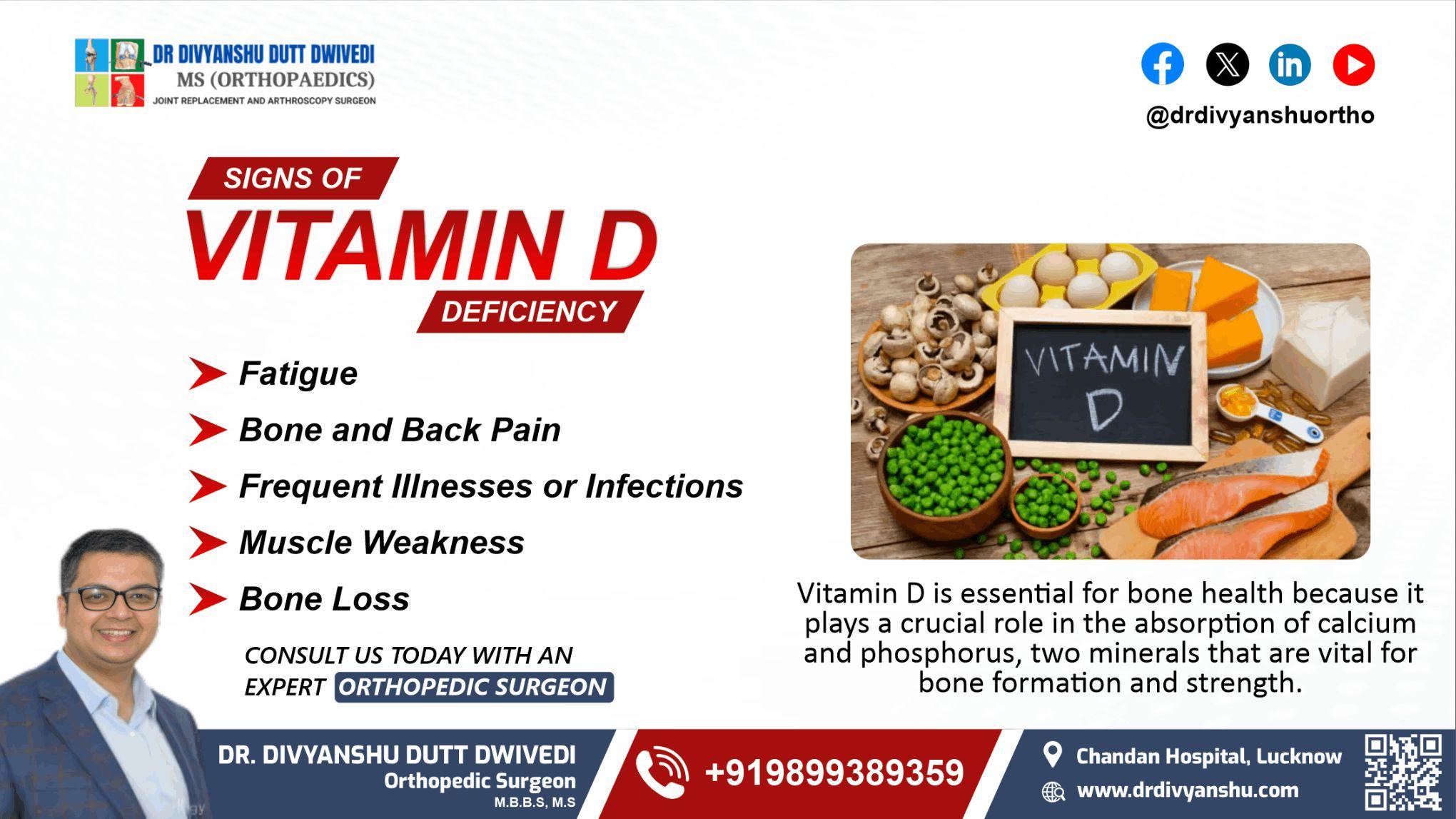 Signs of Vitamin D Deficiency 