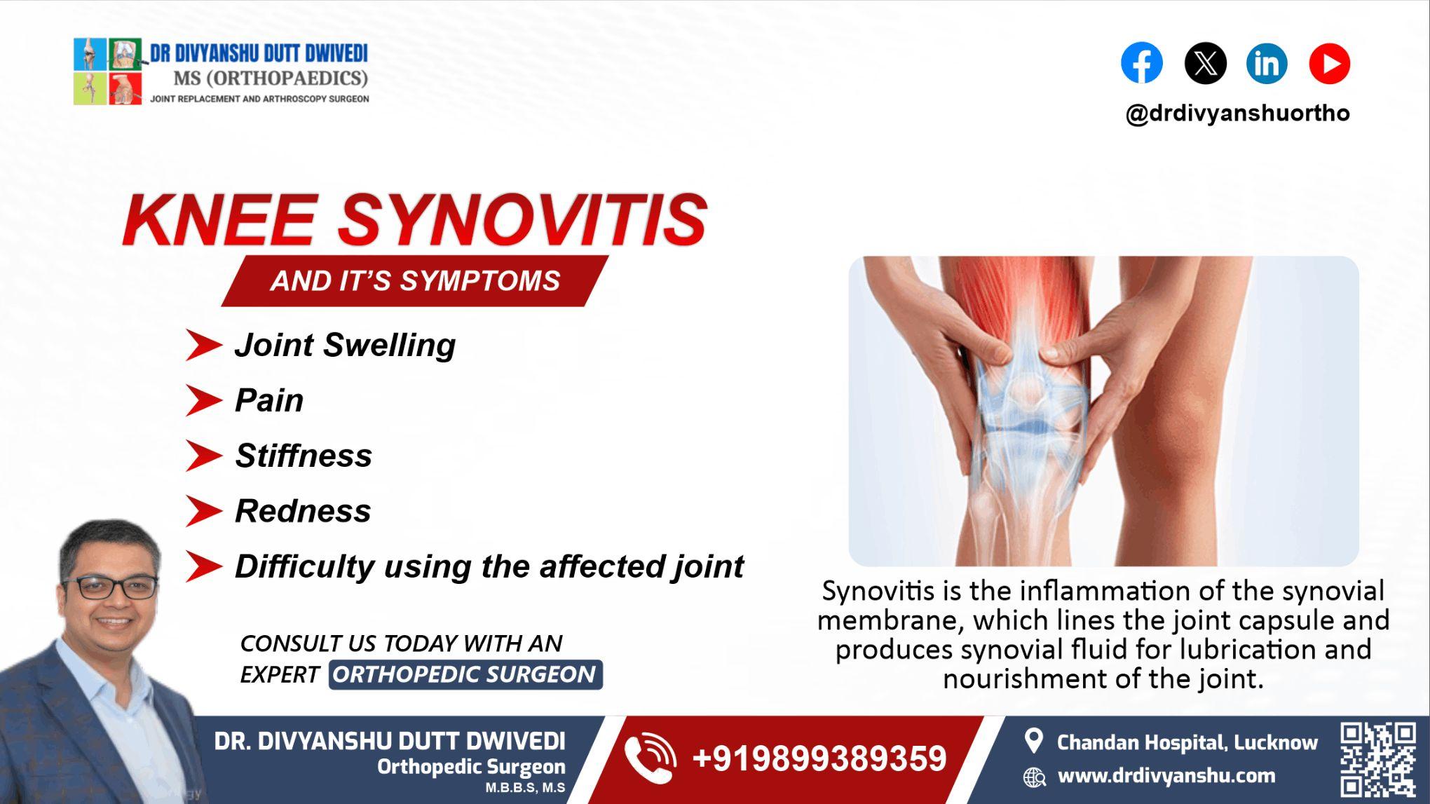 Knee Synovitis and Its Symptoms