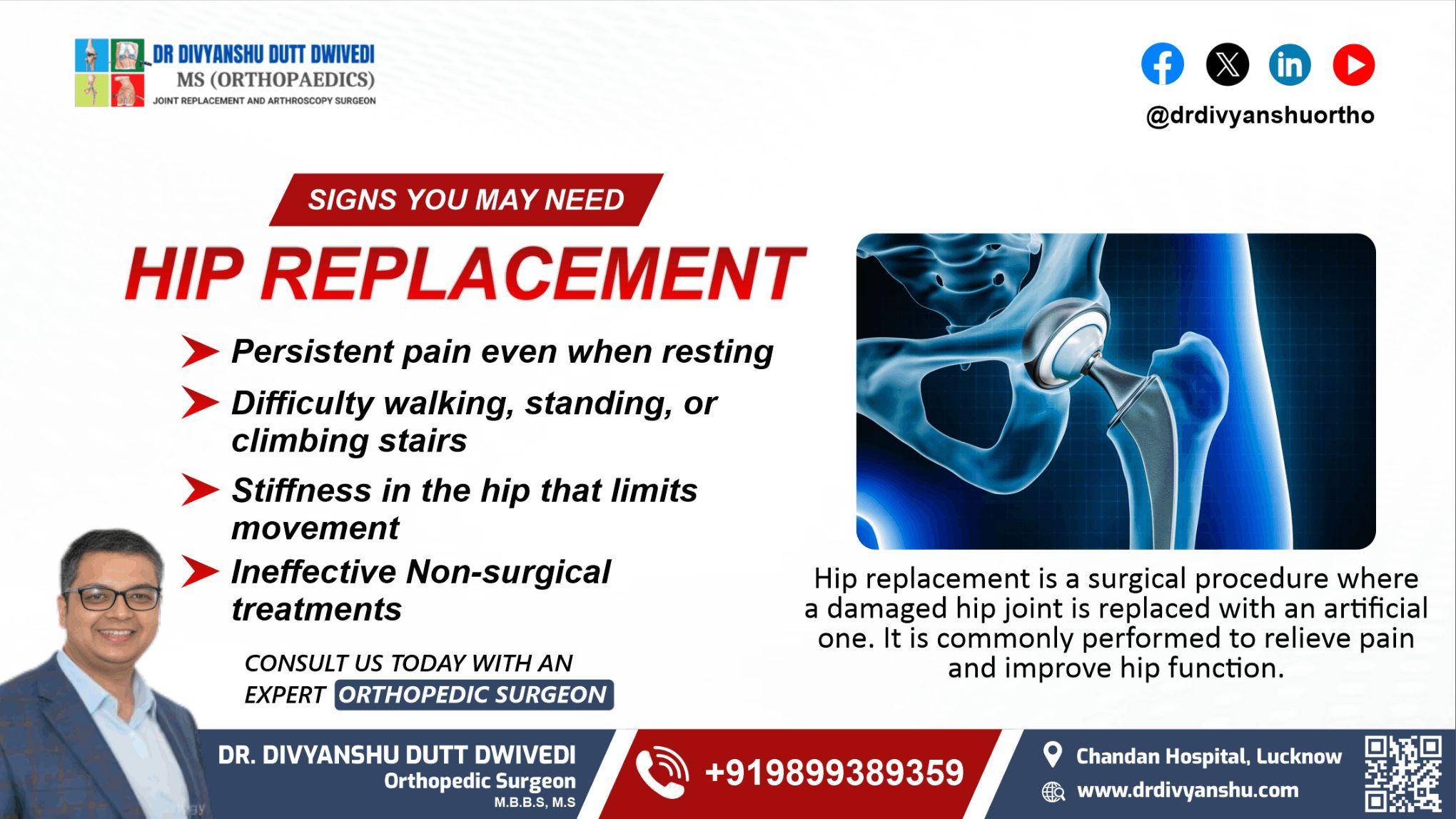 Signs You May Need a Hip Replacement