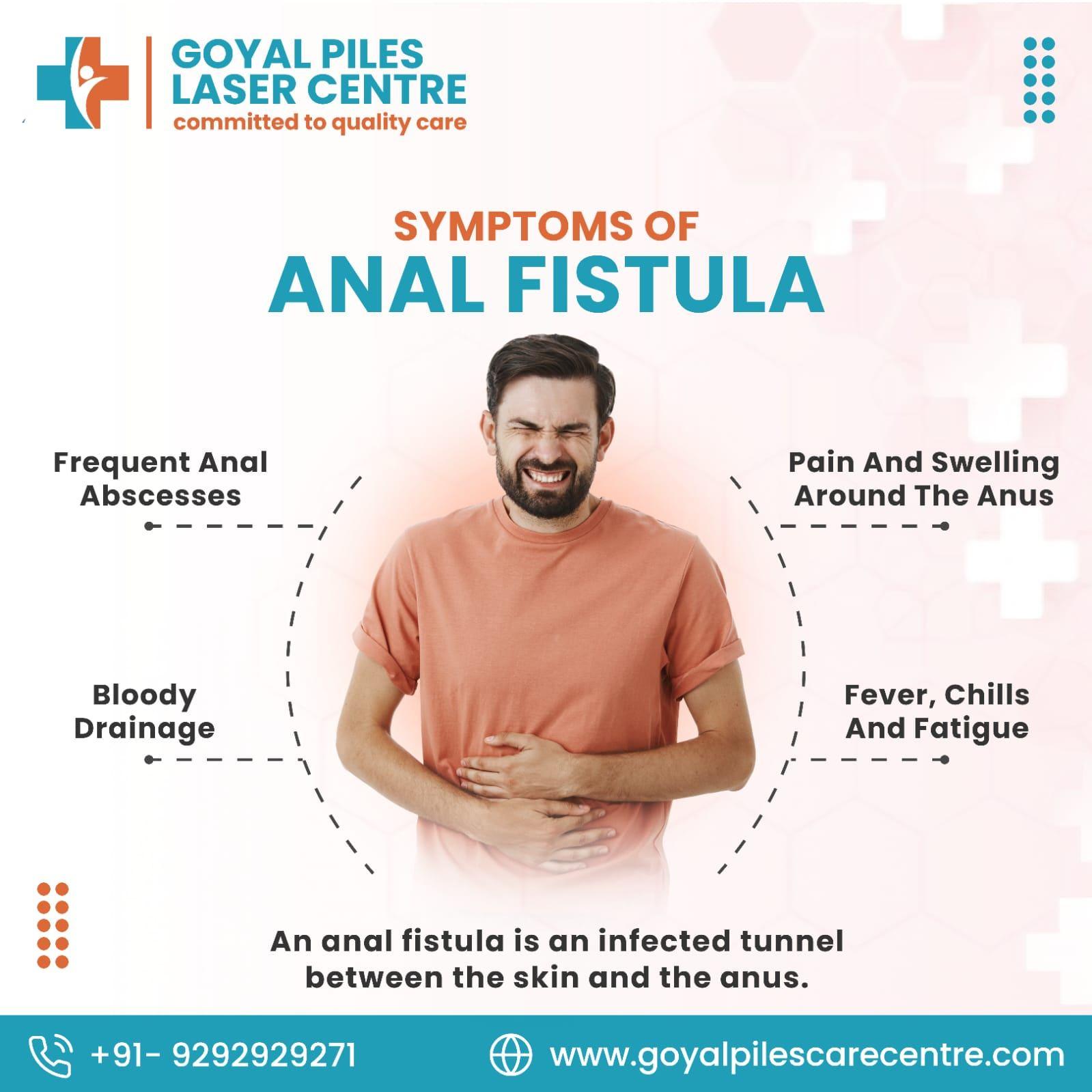  Best Piles Clinic Near Me |Goyal piles laser Centre
