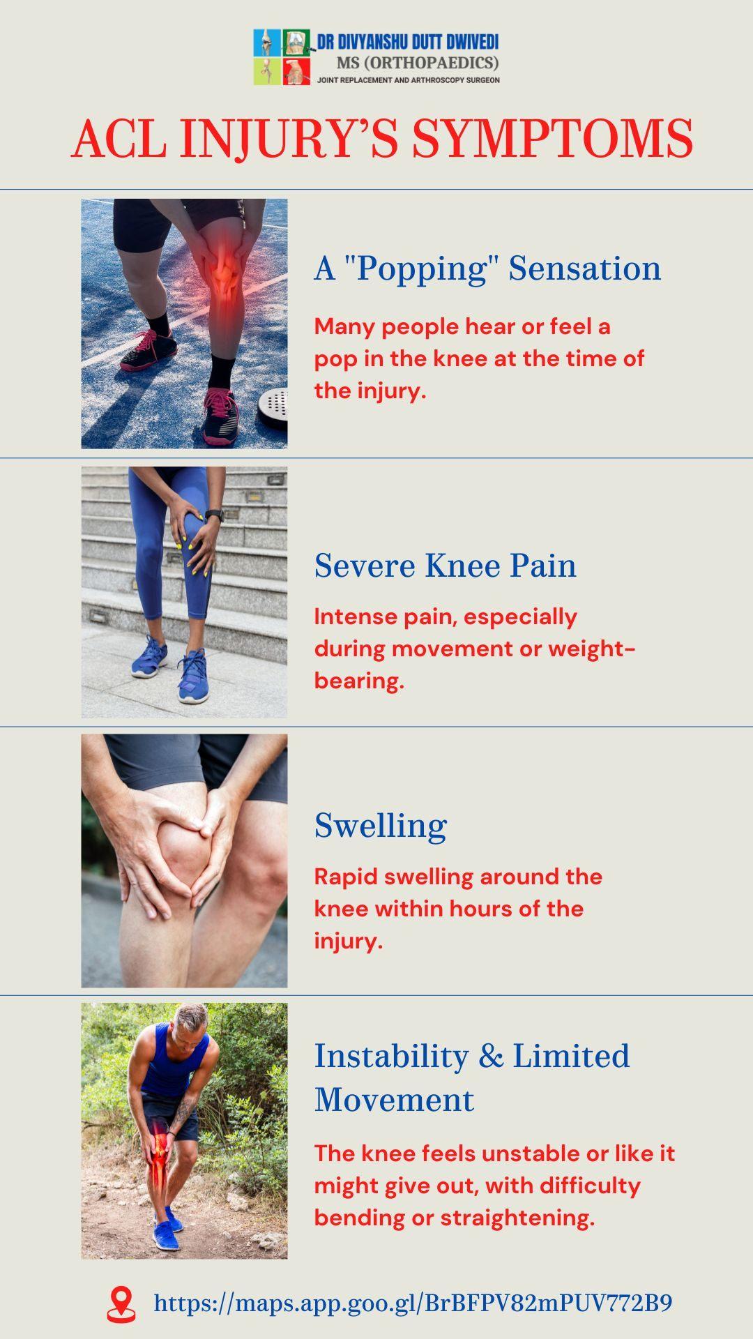 ACL Injury Symptoms You Shouldn't Ignore 