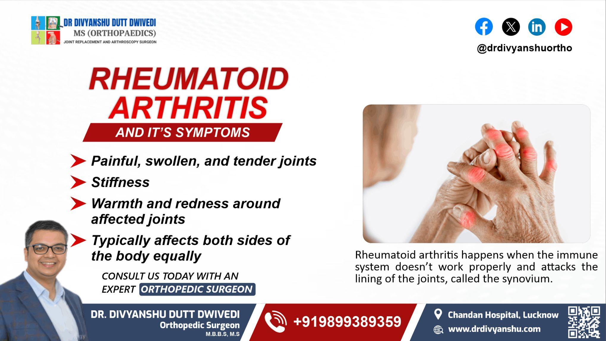 Rheumatoid Arthritis And Its Symptoms:
