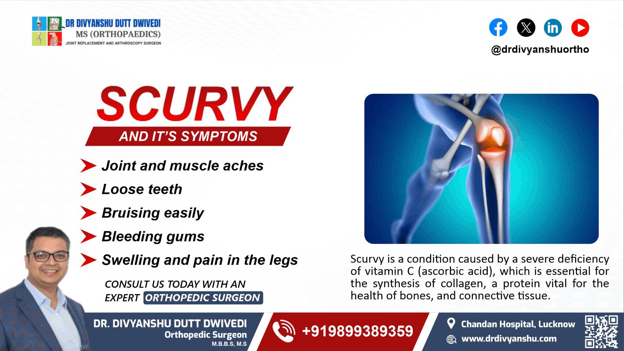 Scurvy and Its Symptoms