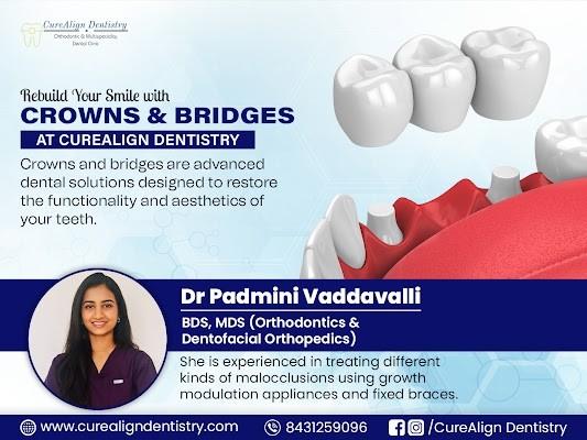 Dental Crowns at Cure Align Dentistry in Konanakunte, Bengaluru