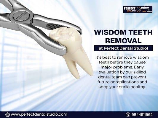 Teeth Whitening in BTM Layout Bangalore - Perfect Dental Studio 