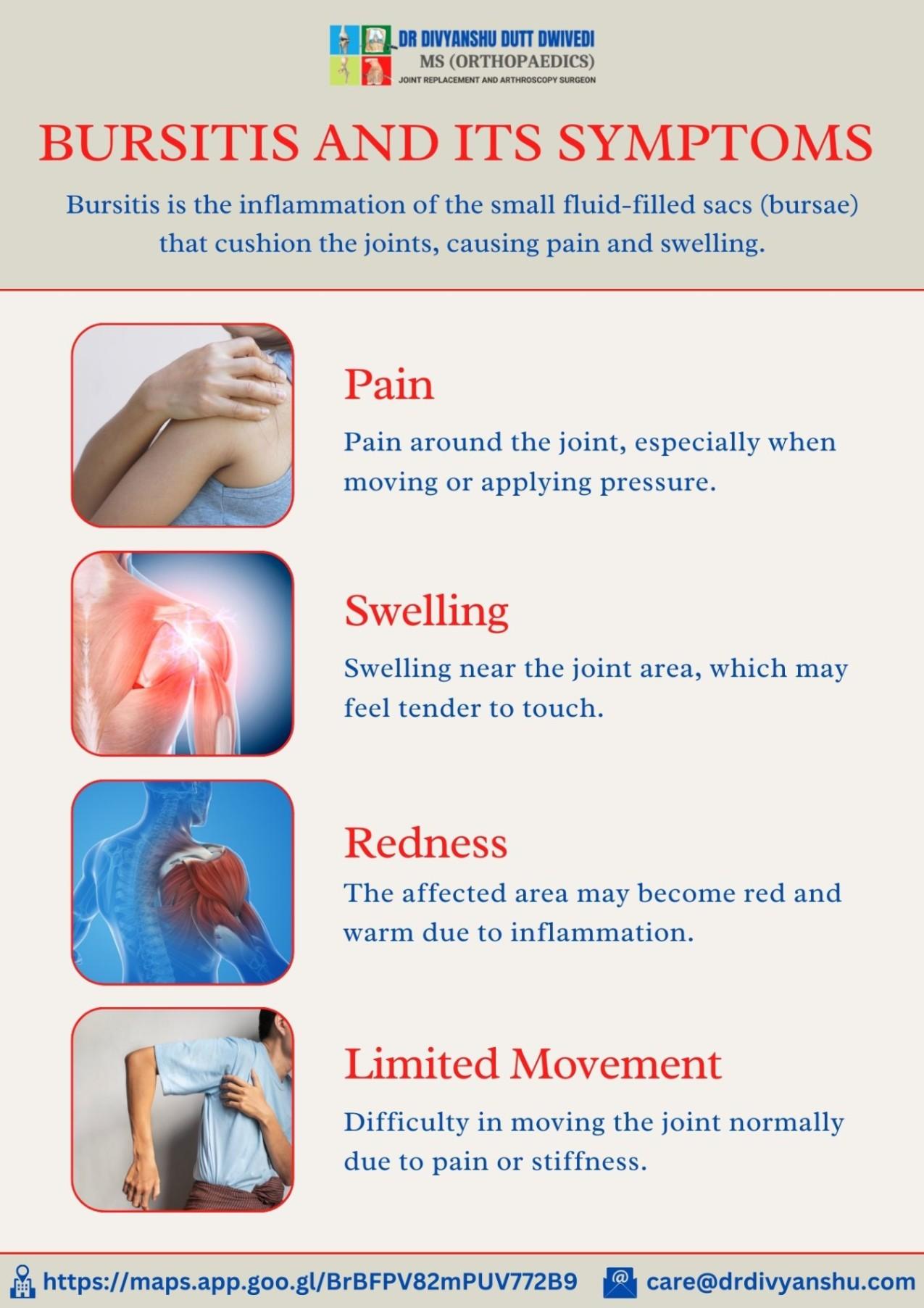 Bursitis and Its Symptoms
