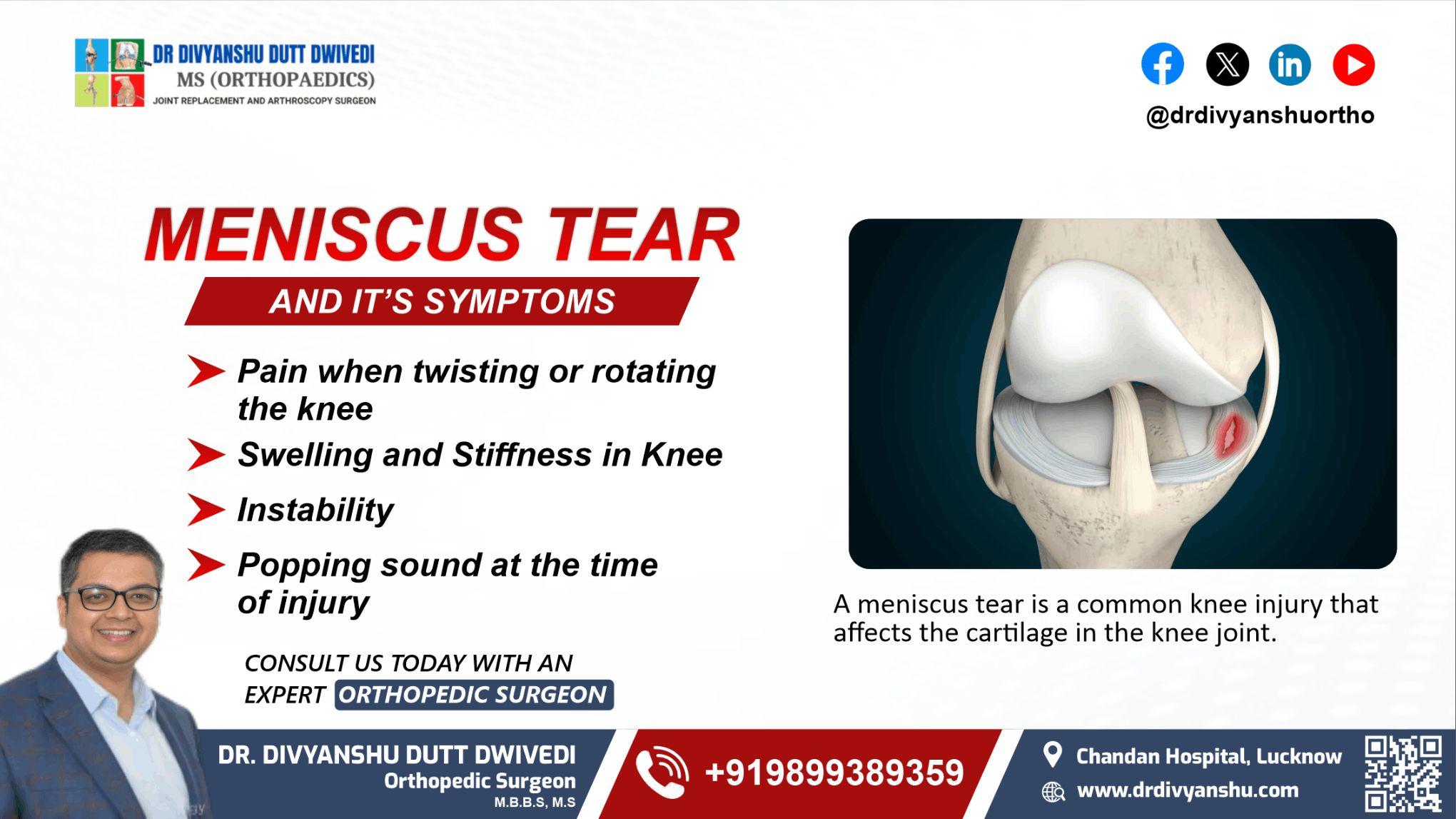 Meniscus Tear And Its Symptoms 
