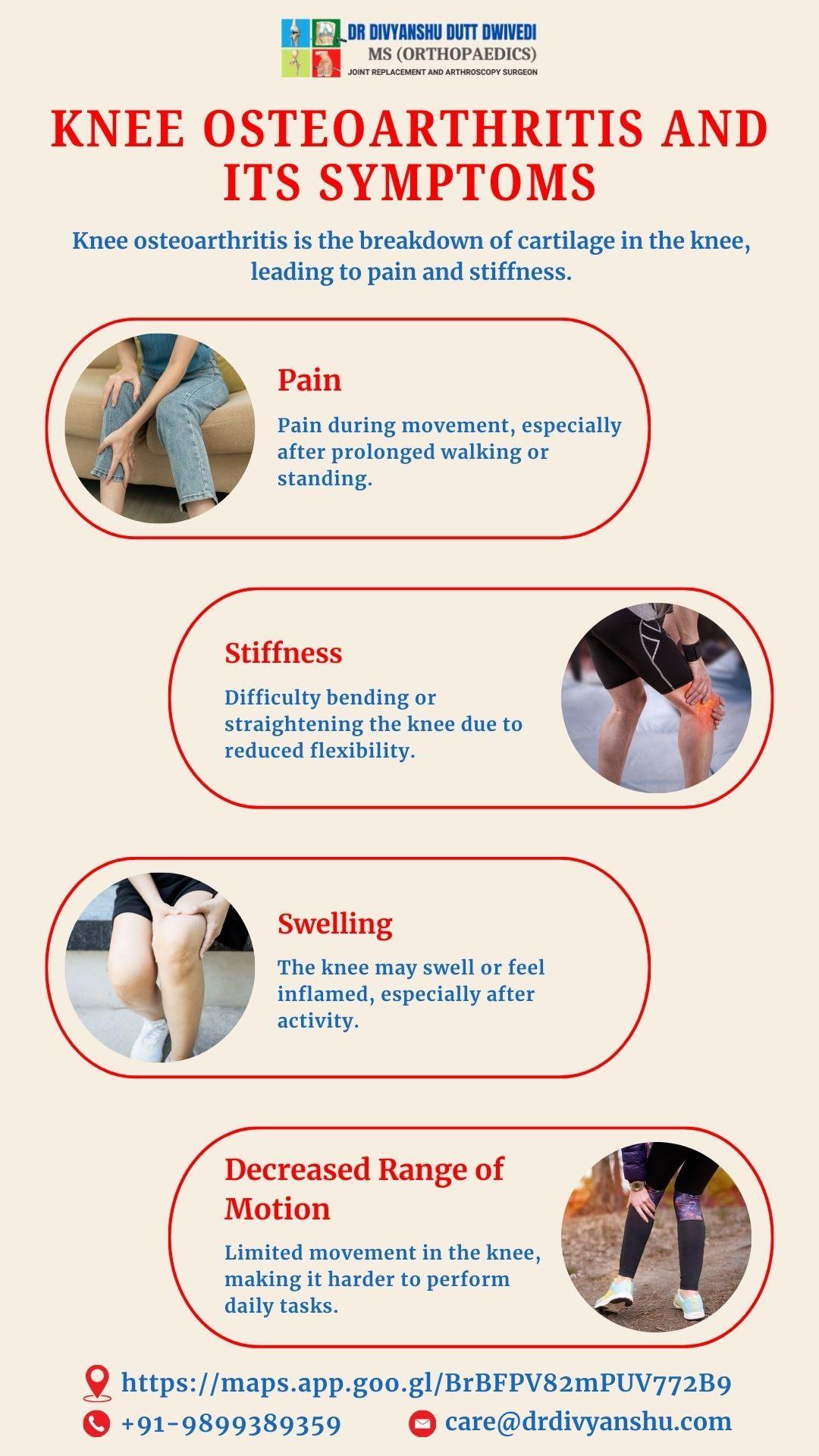 Knee Osteoarthritis and Its Symptoms