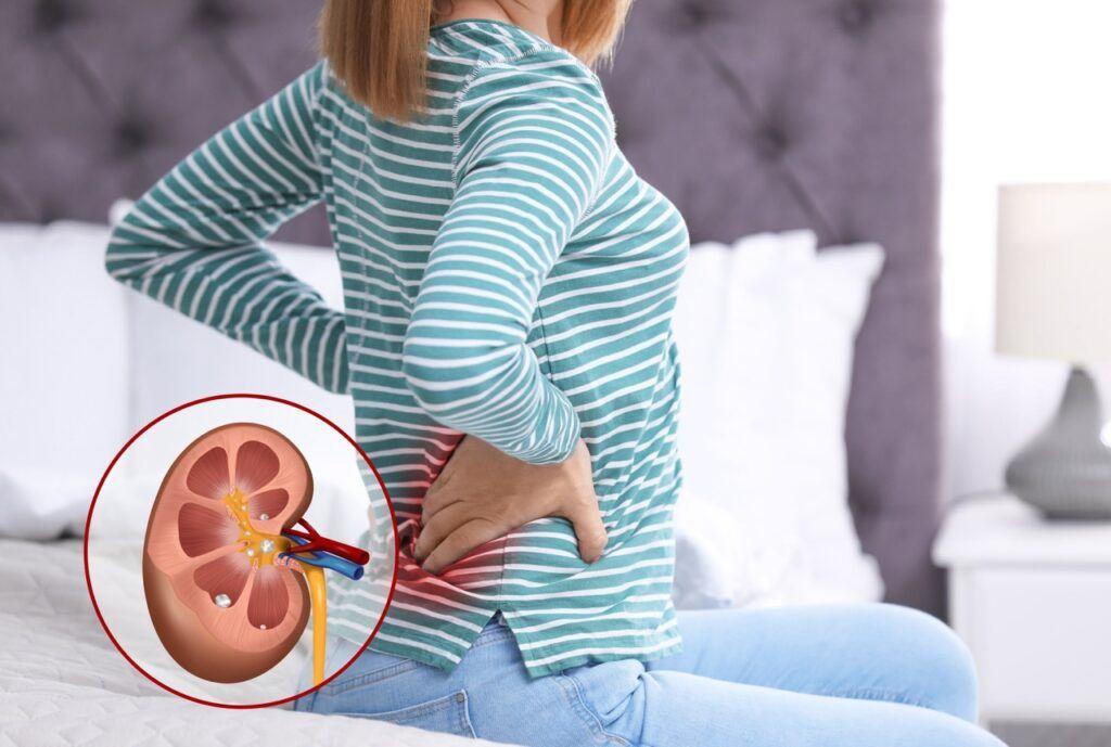 How can I manage pain after kidney stone surgery?
