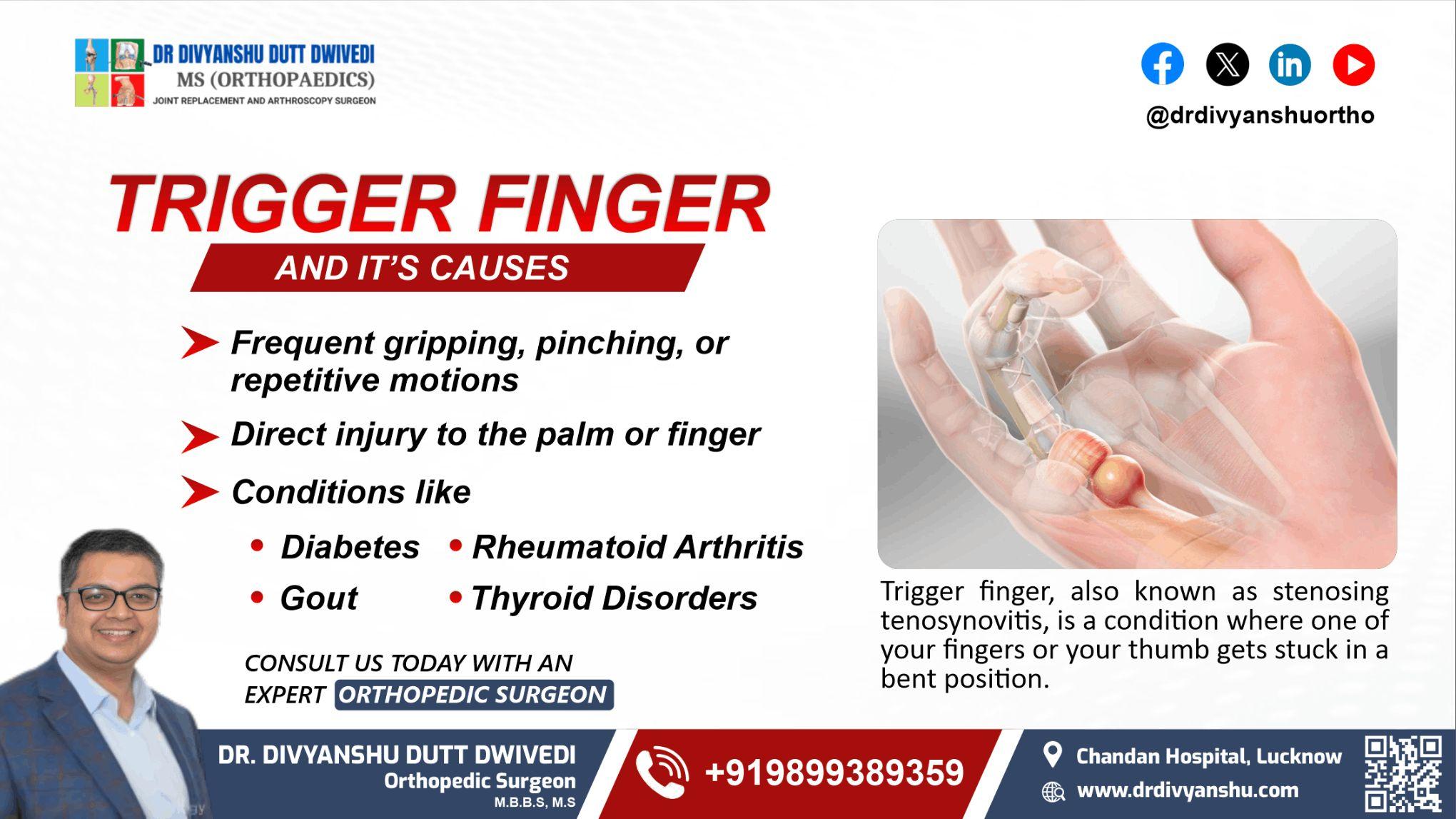 Trigger Finger and Its Causes 