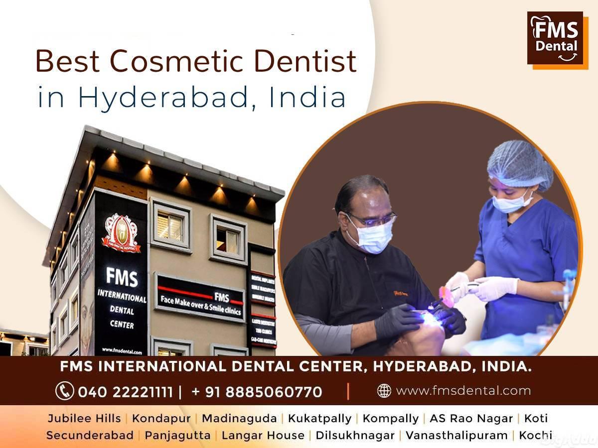 Best Cosmetic Dentist In Hyderabad India