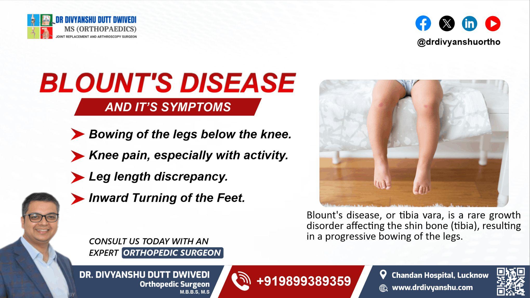Blount's Disease And Its Symptoms