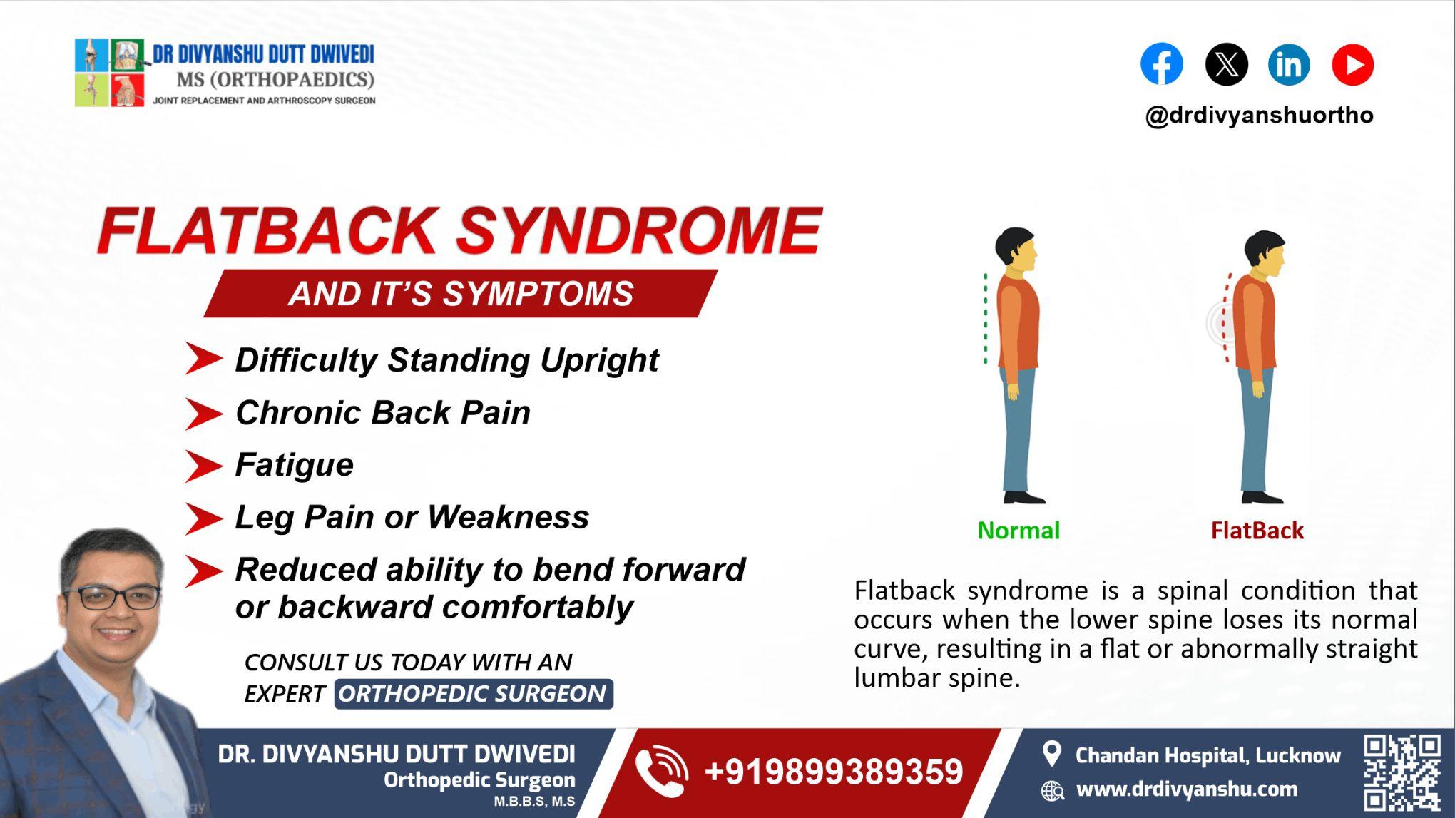 Flatback Syndrome: Key Symptoms to Recognize