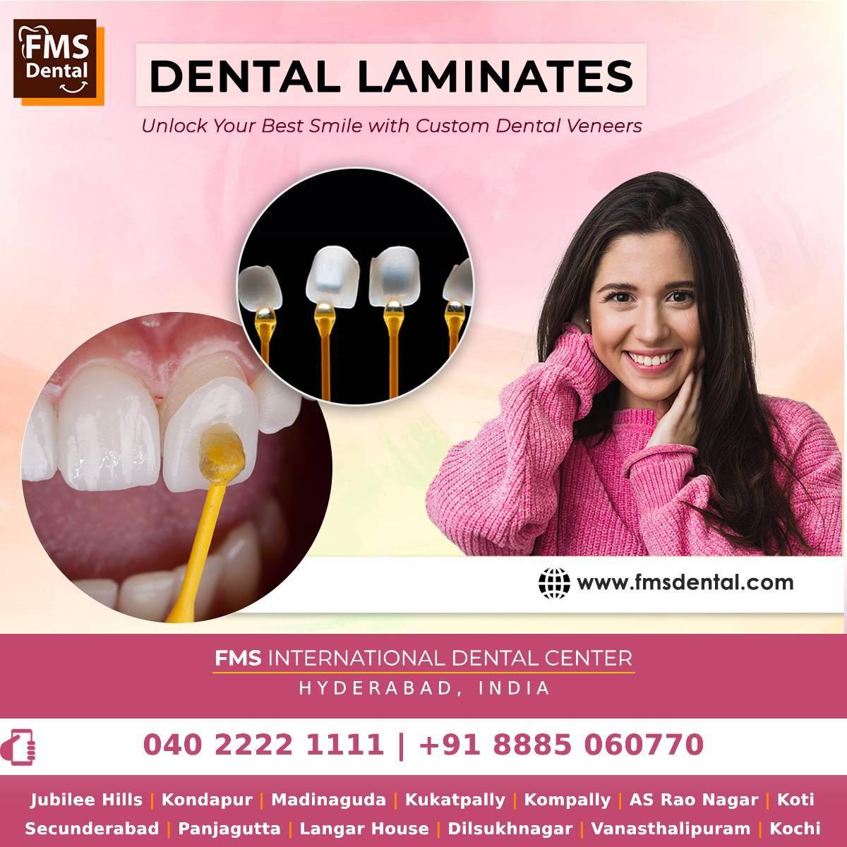 Dental Teeth Veneer Treatment in India at FMS Dental Hospital, Hyderabad