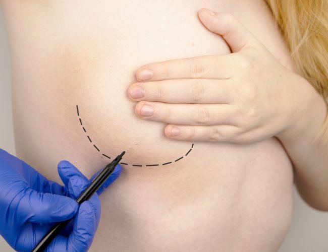 Best Breast,Diabetic Foot Surgeries and Wound Cleaning in Basavanagudi Bangalore