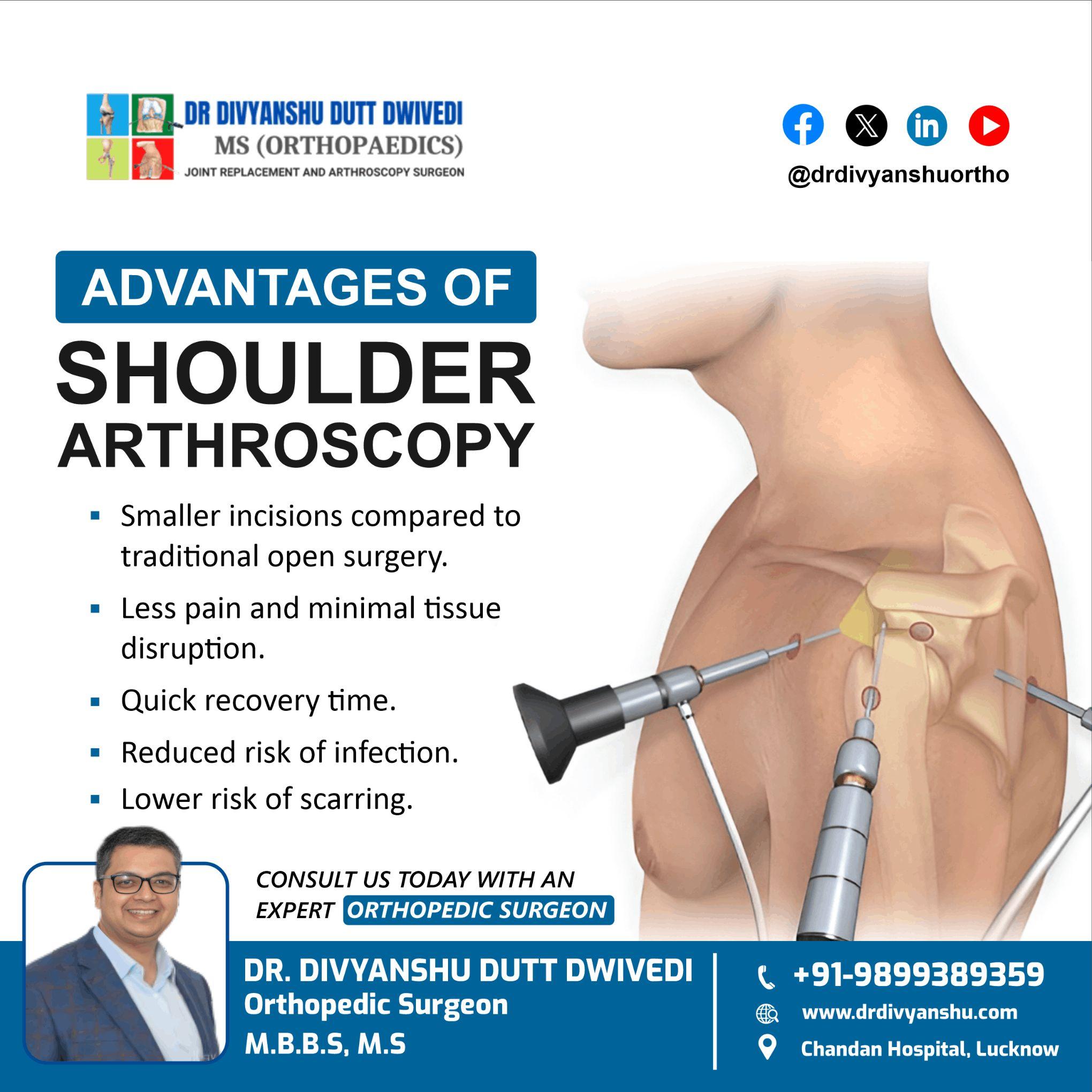 Advantages of Shoulder Arthroscopy 