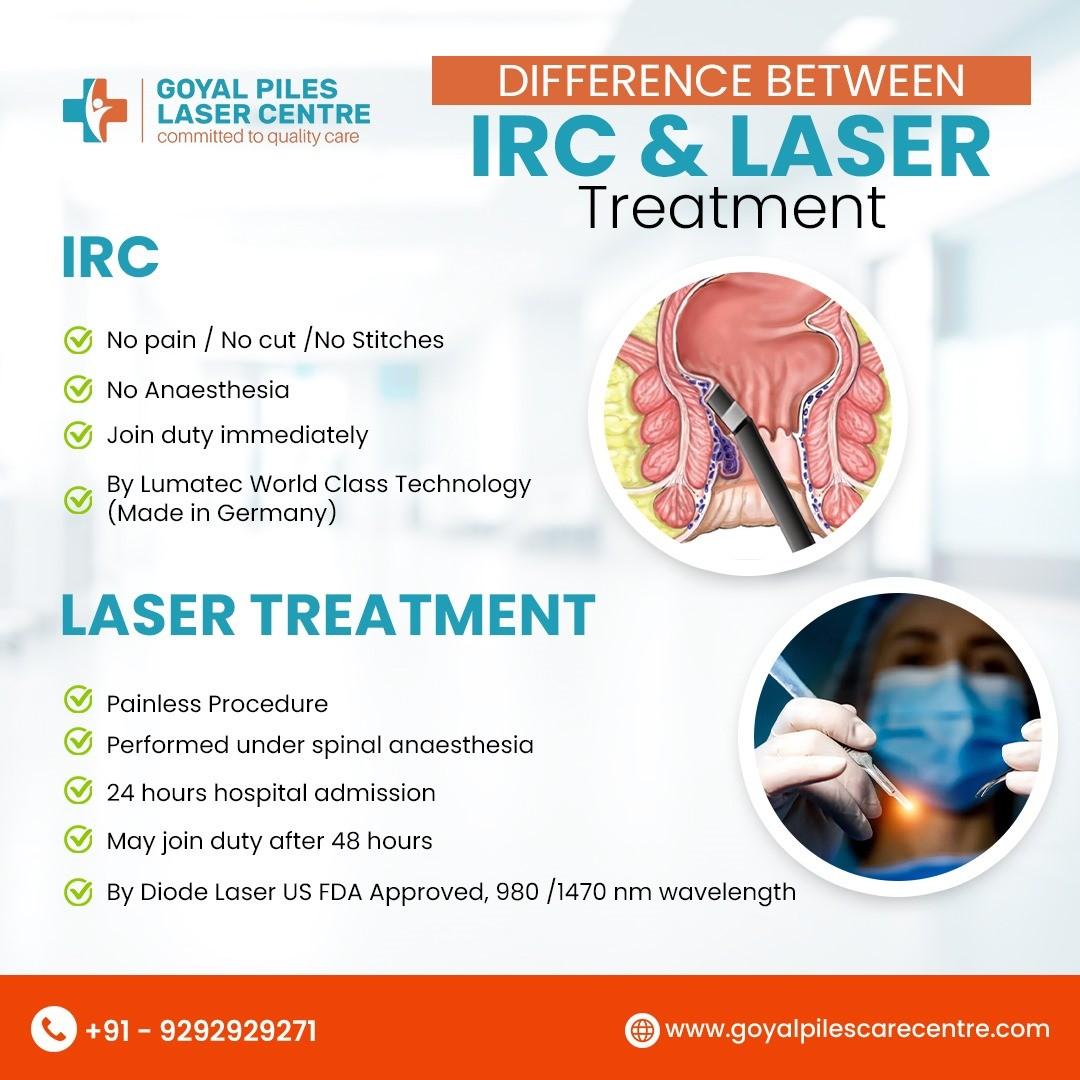 Piles Treatment Without Surgery  | Goyal Piles Laser Centre