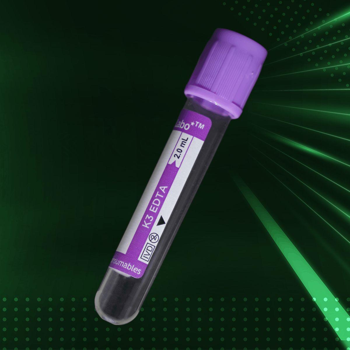 Quality EDTA Tubes for Blood Collection by AV Consumable: A Trusted Choice