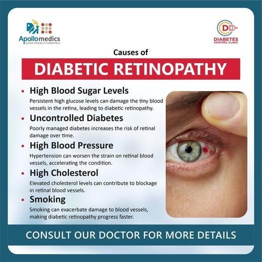 Stop Diabetic Retinopathy in Its Tracks!