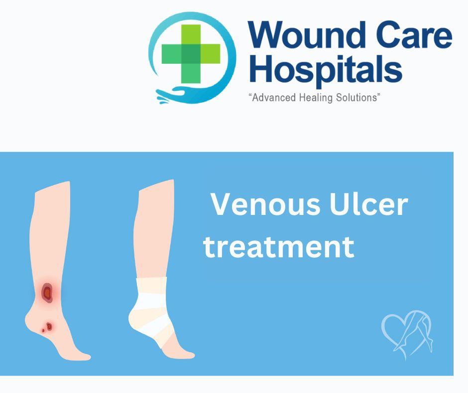 Best Venous Ulcer treatment in Hyderabad | Kukatpally | KPHB - WCH