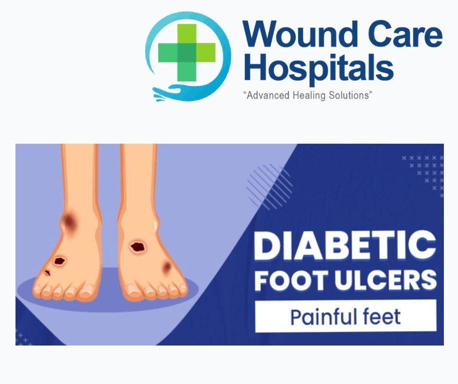 Best Diabetic Foot Ulcer Treatment in Hyderabad | Kukatpally | KPHB - WCH
