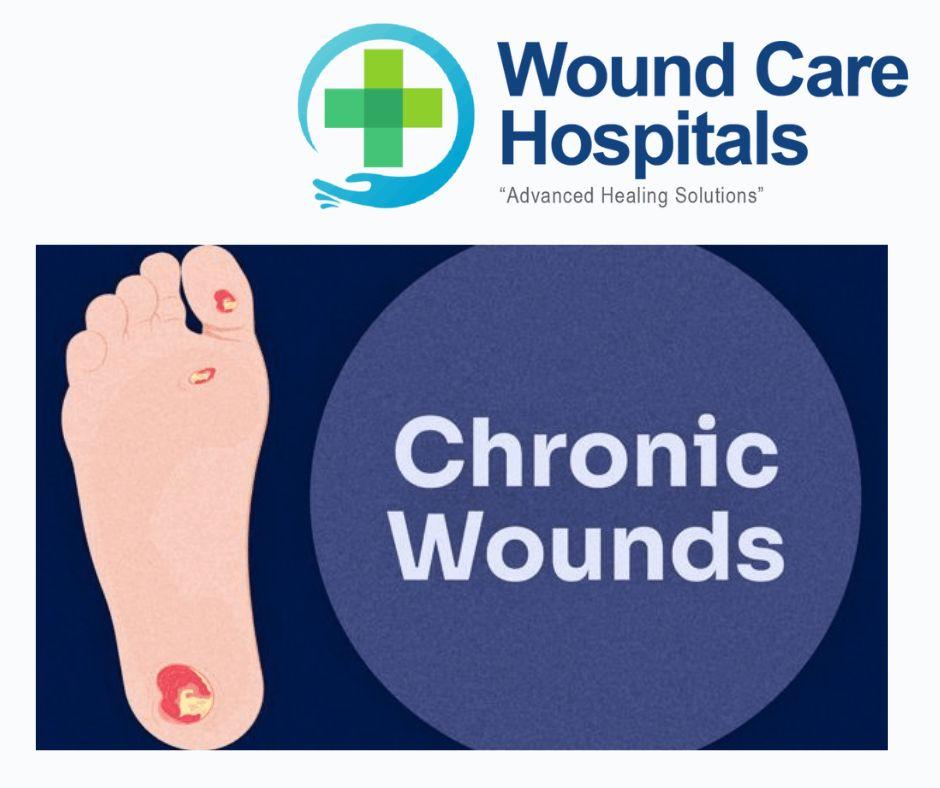 Chronic Wounds Treatment in hyderabad | Kukatpally | KPHB - WCH