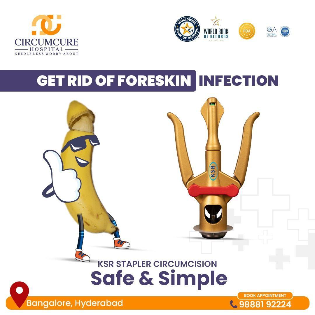 KSR Stapler Circumcision in hyderabad | Bangalore - Circumcure