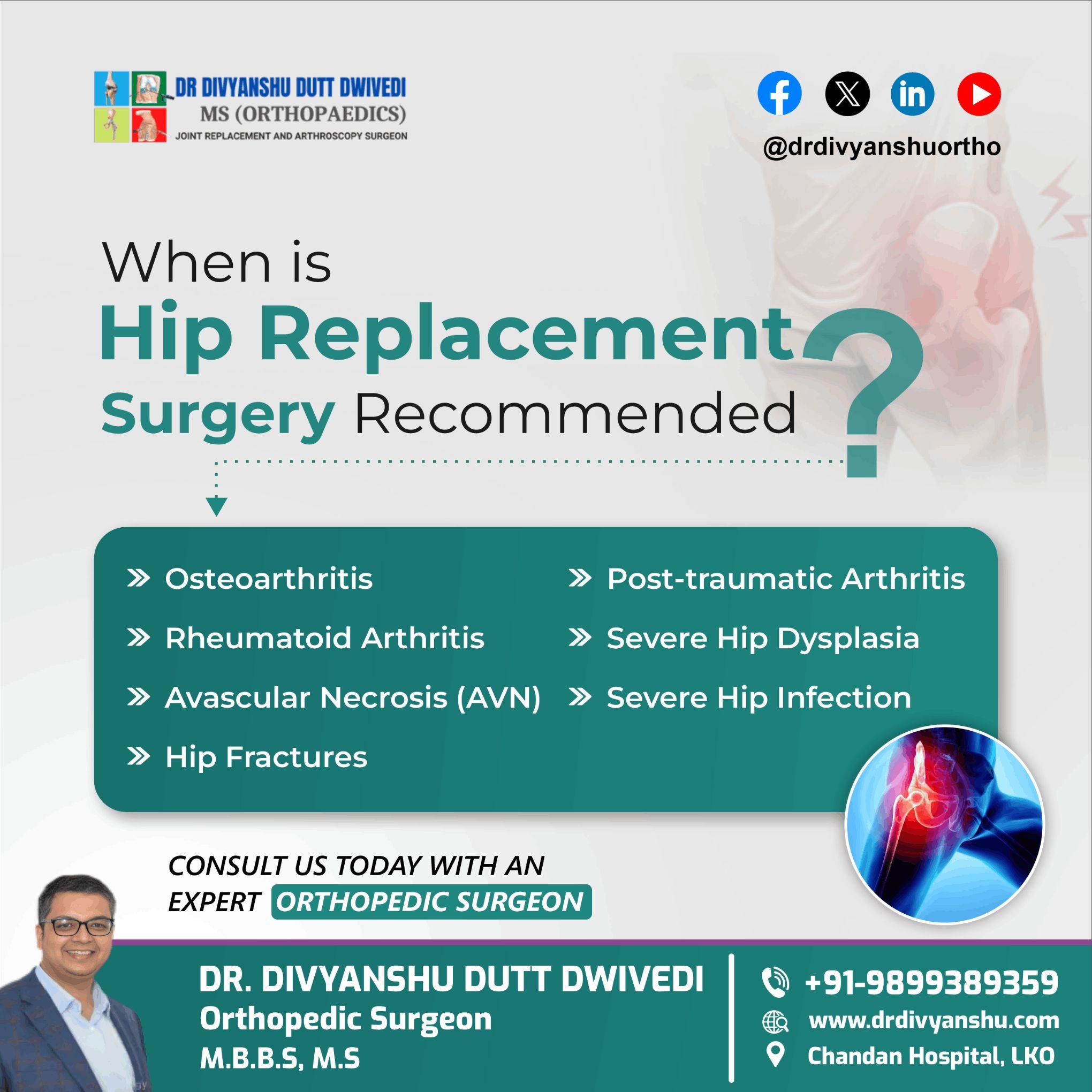 When is Hip Replacement Surgery Needed? 