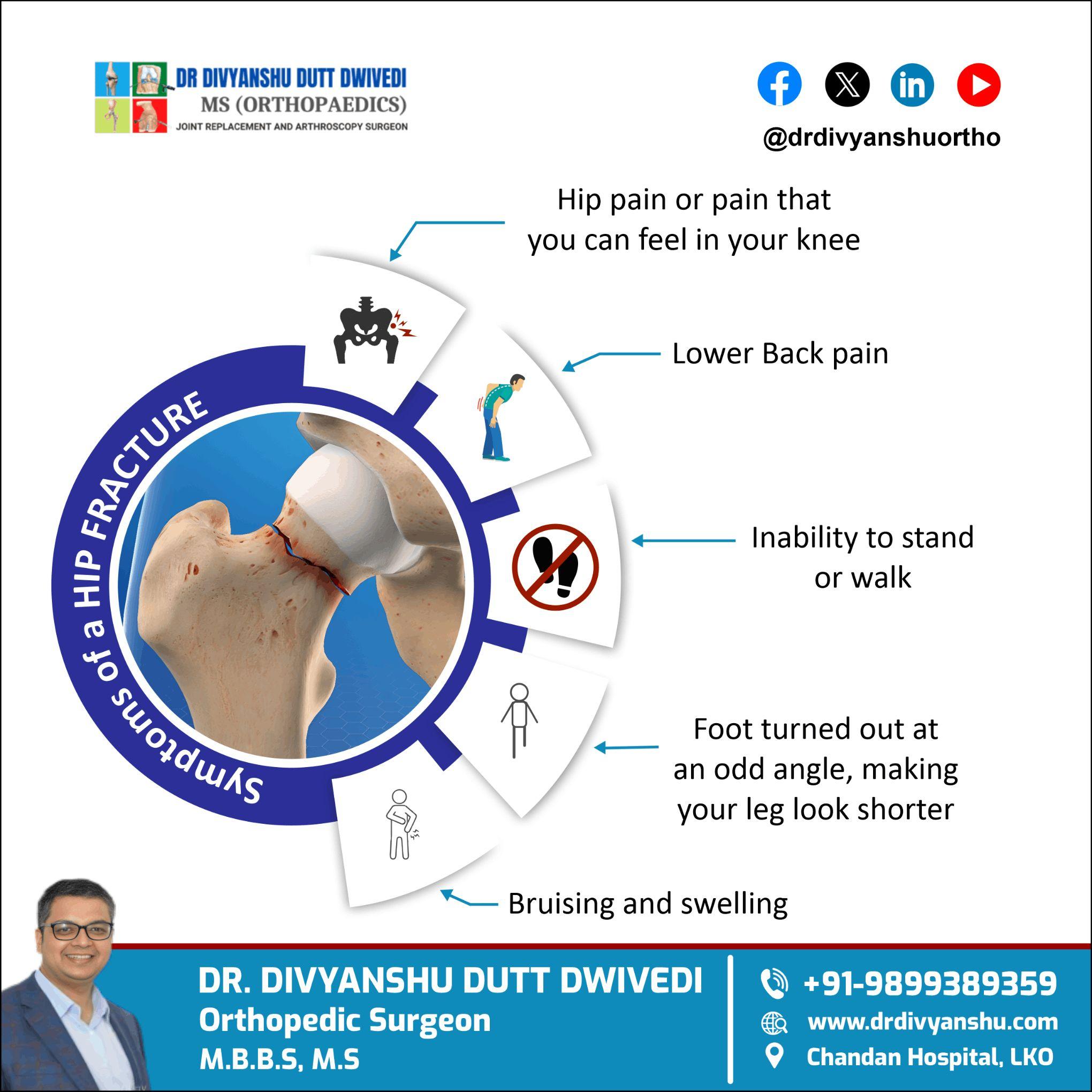 Know the Signs of a Hip Fracture