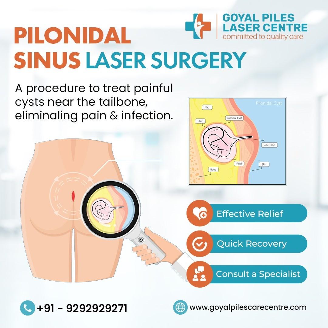 Fissure Specialists Near Me | Goyal Piles Laser Centre