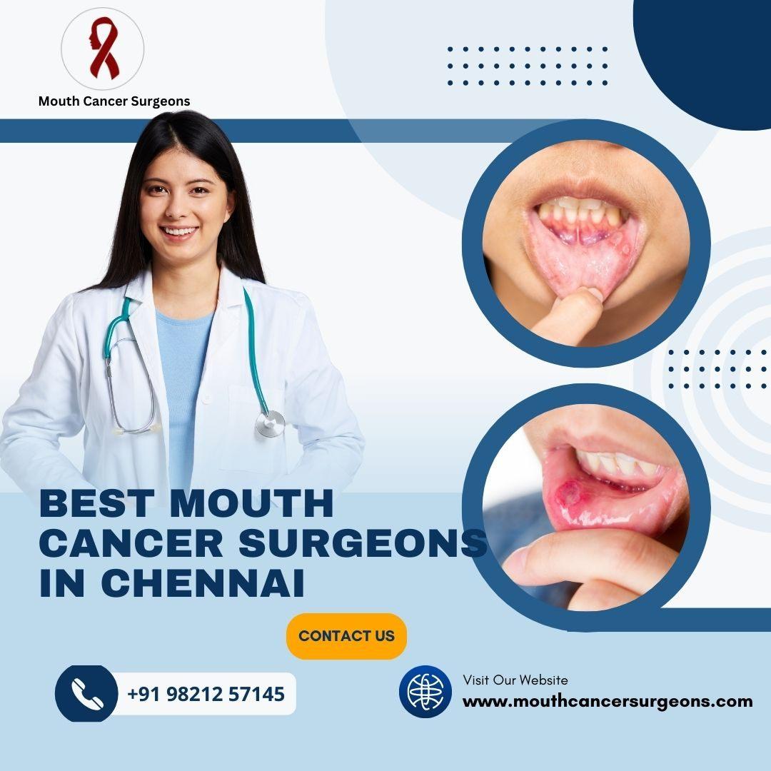 Oral Cancer Treatment Doctors in Chennai | Mouth Cancer Surgeons