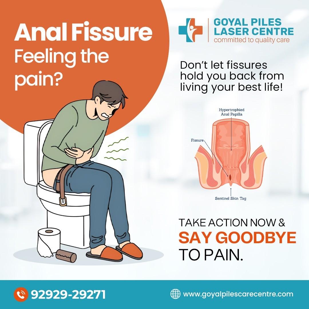  Piles Specialists Near Me | Expert Hemorrhoid Care | Goyal Piles Laser Centre