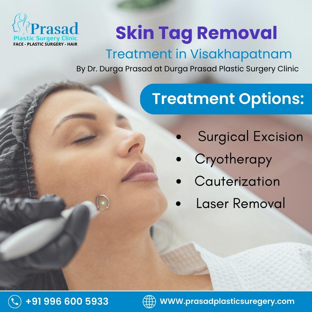 Skin Tag Removal Treatment in Visakhapatnam 