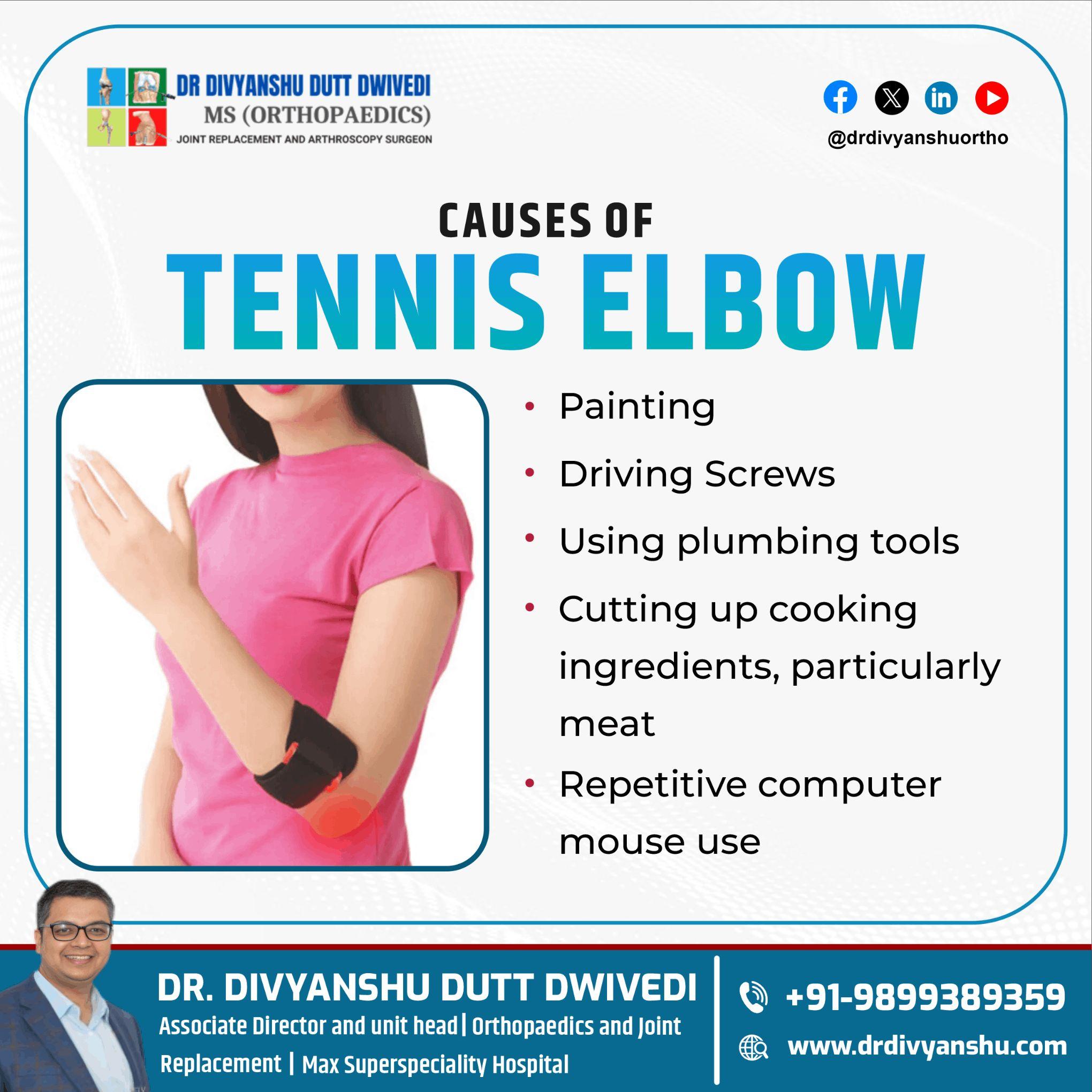 Dr. Divyanshu Dutt Dwivedi Expert Care for Tennis Elbow