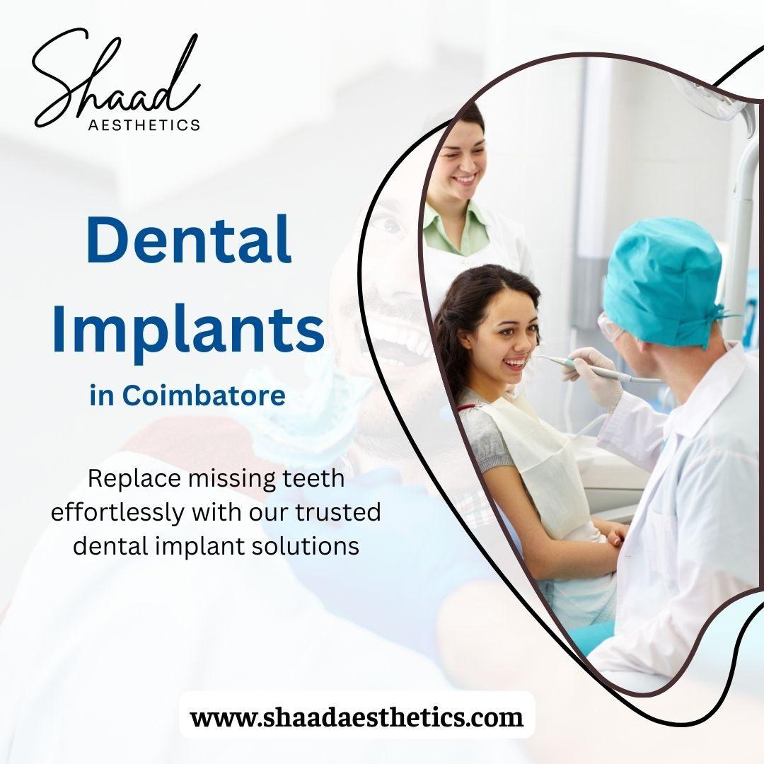 Dental Implants in Coimbatore | Shaadaesthetics Dental Clinic
