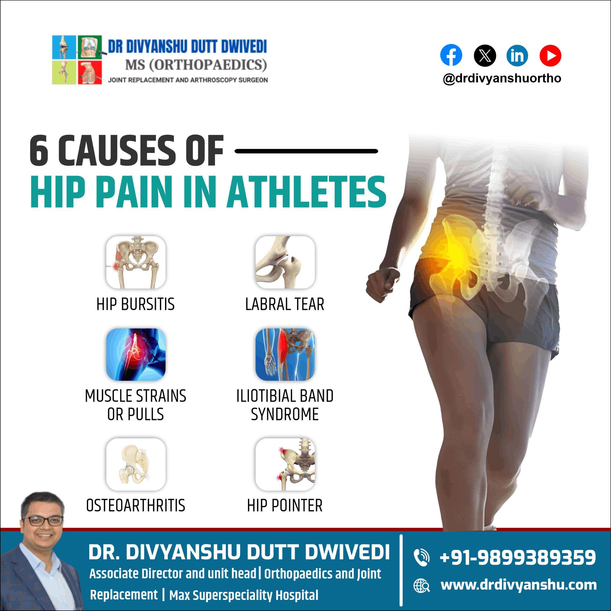 6 Causes of Hip Pain in Athletes Dr. Divyanshu Dutt Dwivedi