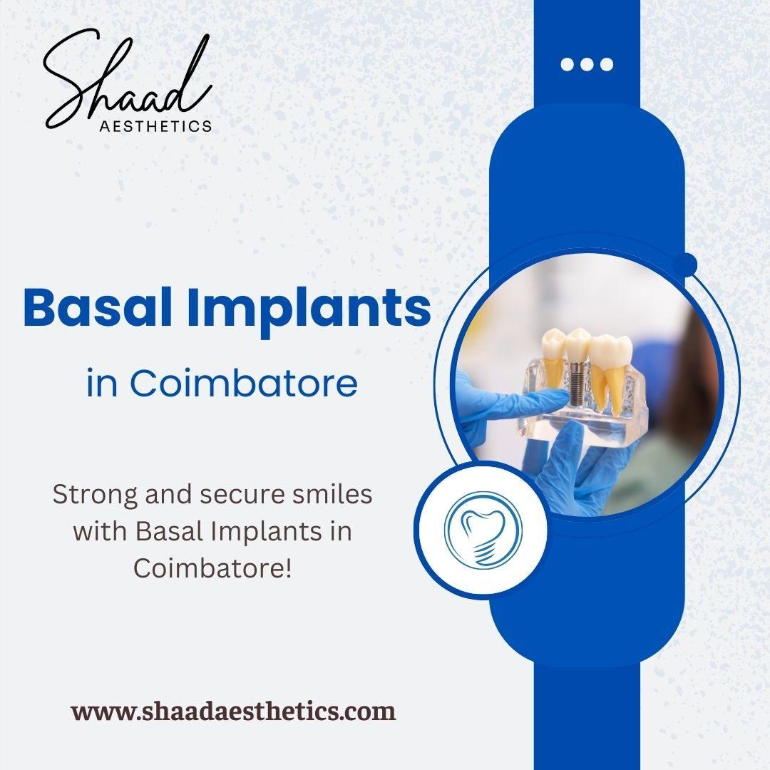 Basal Implants in Coimbatore | Shaadaesthetics