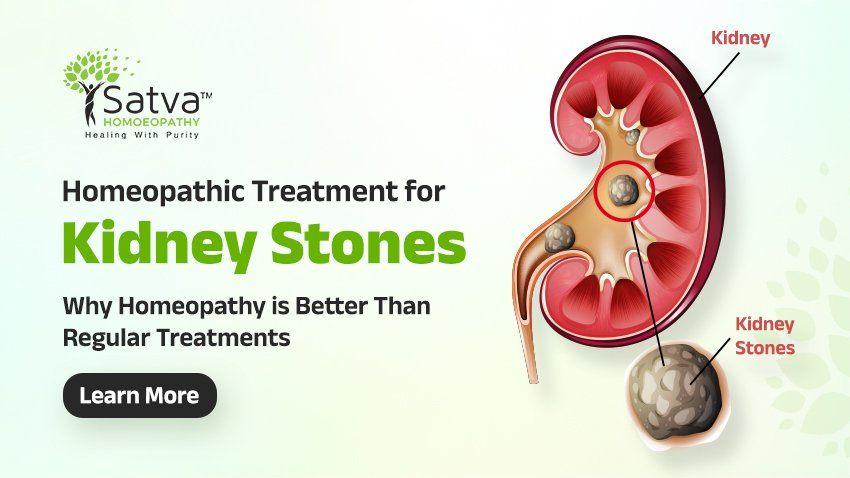 Homeopathic treatment for Kidney Stones in Surat. Satva Homoeopathy Clinic