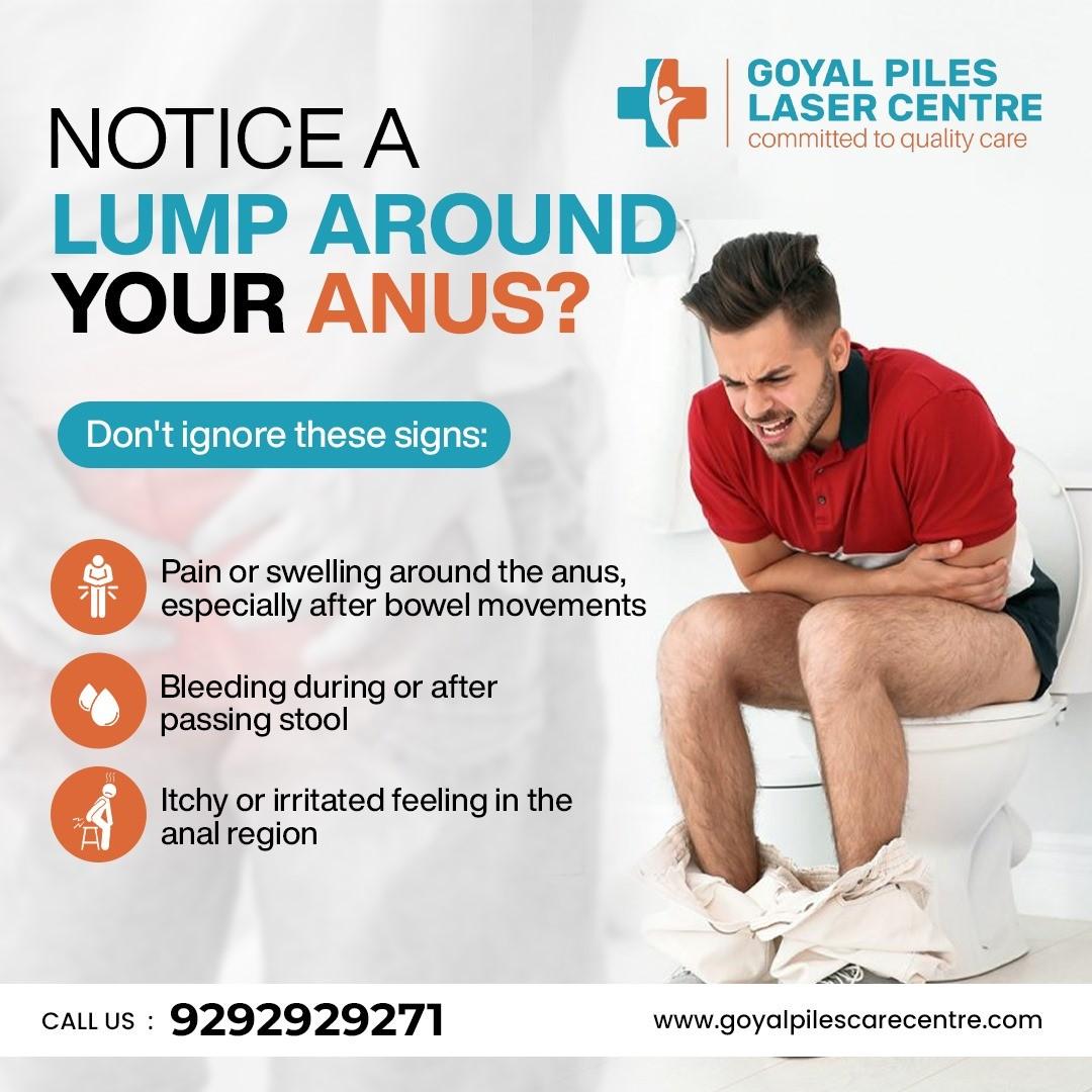  Best Piles Doctor Near Rohini | Goyal Piles Laser Centre