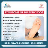 Diabetic Foot Symptoms & Treatment Call for Expert Advice