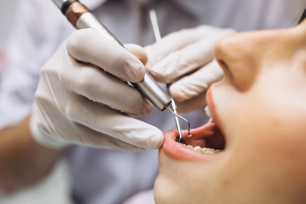 Everything About Root Canal Treatment in Navi Mumbai