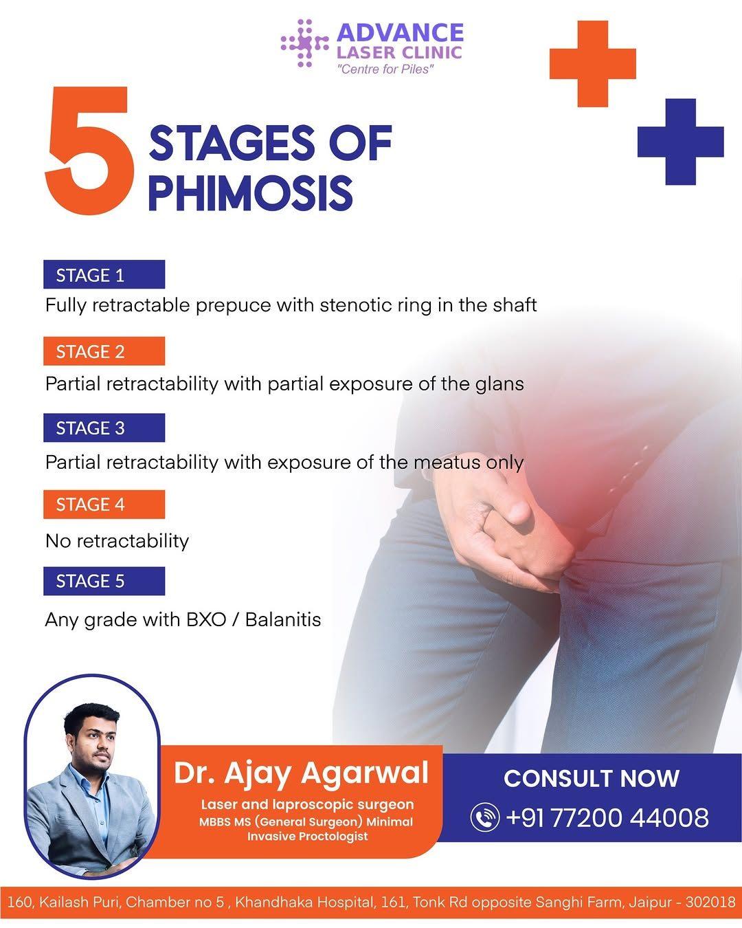 ZSR Circumcision doctor in Jaipur