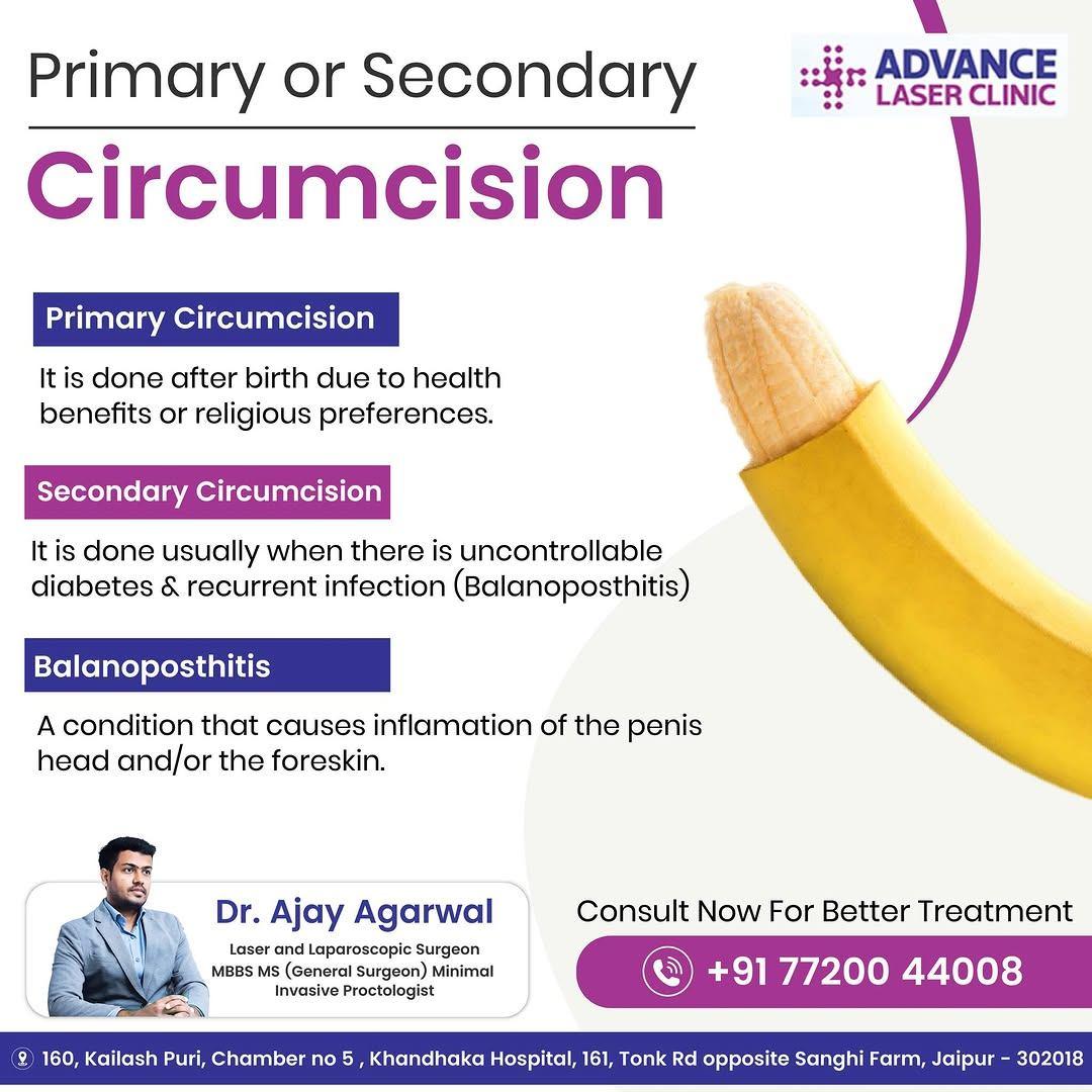 ZSR Circumcision doctor in Jaipur