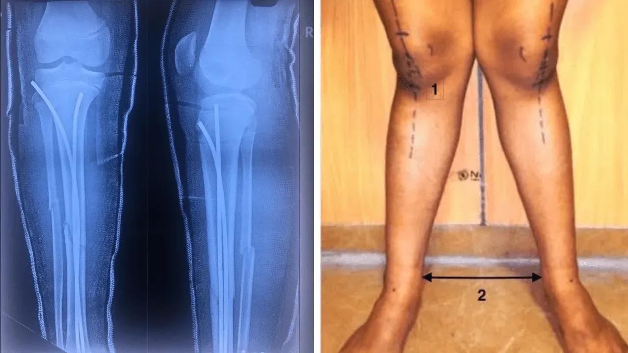 BEST ORTHOPEDIC IN LUCKNOW