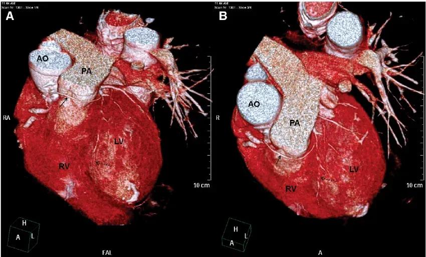 3D CT Scan with VRT Imaging in Navi Mumbai