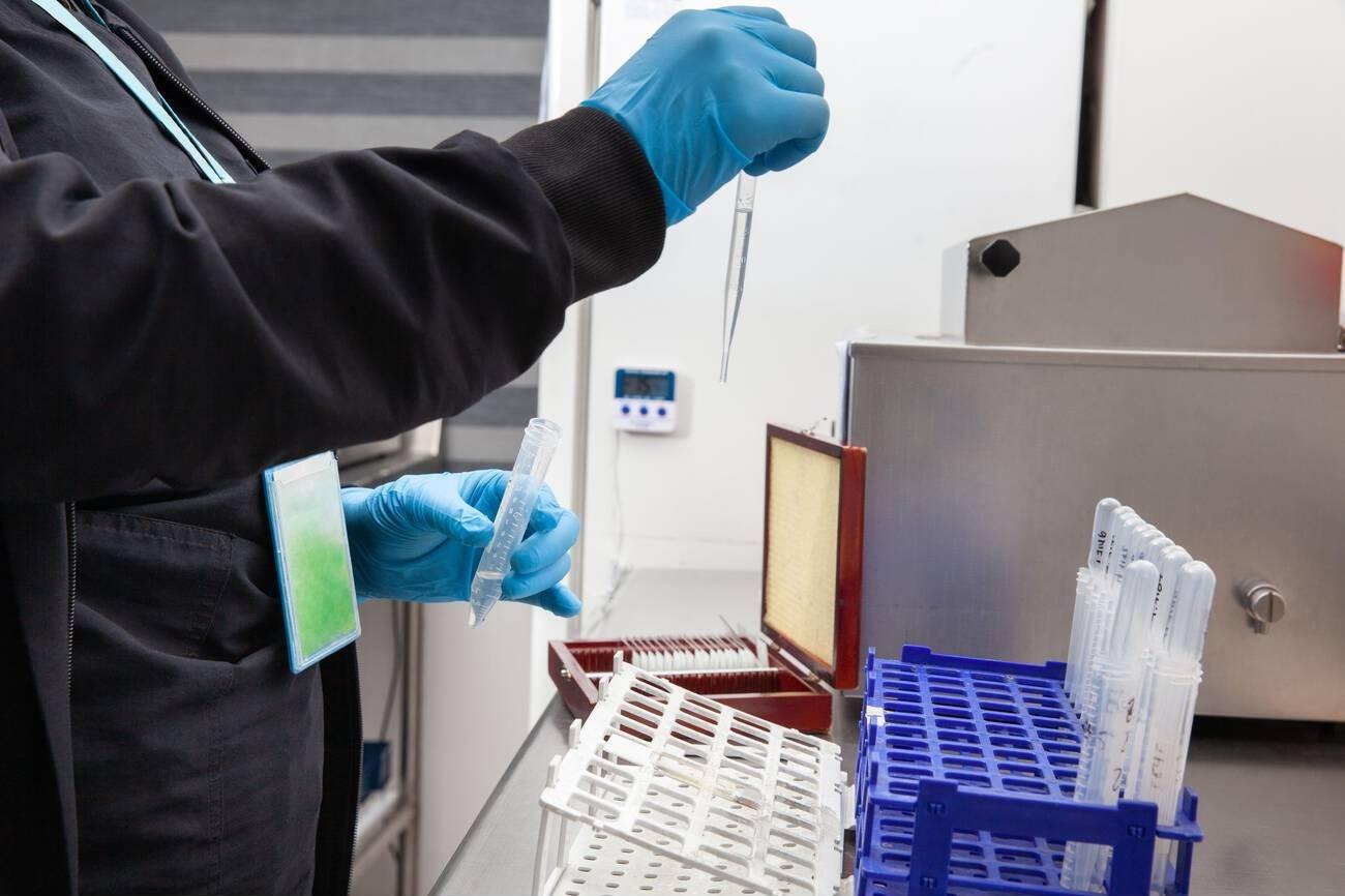 Karyotype Test for Genetic Disorders