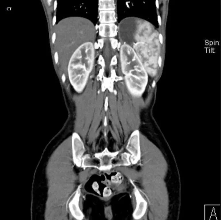 Whole Body CT Scan in Navi Mumbai