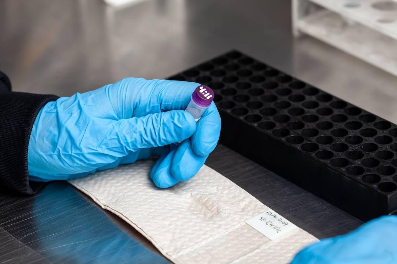 Karyotype Test in Navi Mumbai